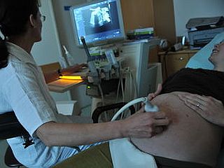 Vatikan pri ZN nasprotuje selektivni predporodni diagnostiki