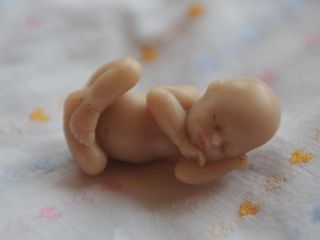 Splav ni temeljna človekova pravica